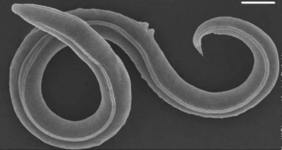 دودة يبلغ عمرها 46 ألف عام