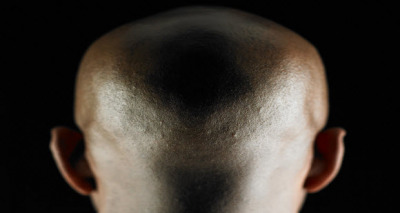 الرؤوس الذهبية