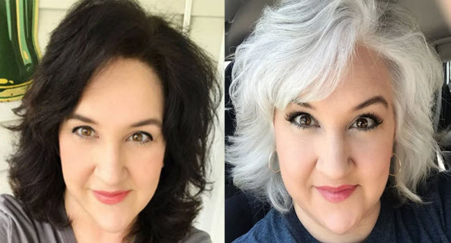 هل متلازمة ماري أنطوانيت التى يتحول فيها الشعر الأسود الى الأبيض بشكل مفاجئ نتيجة الخوف و التوتر حقيقية ؟