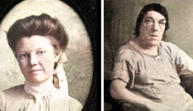 قصة ماري أن بيفان التى شاركت فى مسابقة أقبح إمرأة و تحملت التنمر على مظهرها من أجل إعالة أبنائها