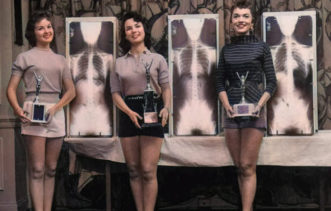 ملكة جمال وضعية الجسد الصحيحة .. مسابقة ترفيهية يتم إختيار الفائزة فيها بإستخدام الأشعة السينية