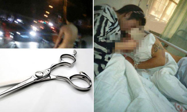 بسبب خيانته .. إمرأة صينية تقطع عضو زوجها الذكري مرتين لتأديبه